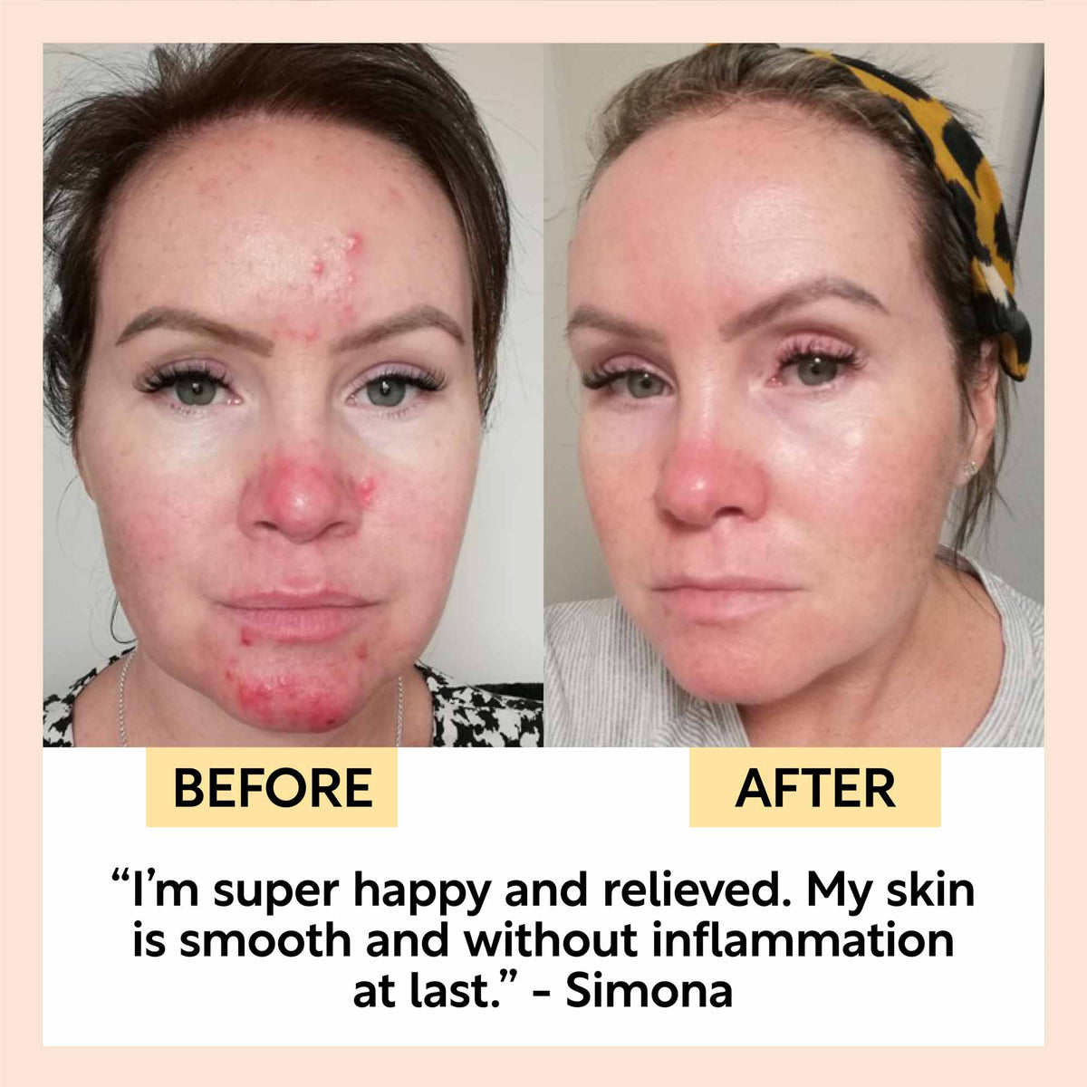 Night Cream with Hyaluronic Acid + Niacinamide
